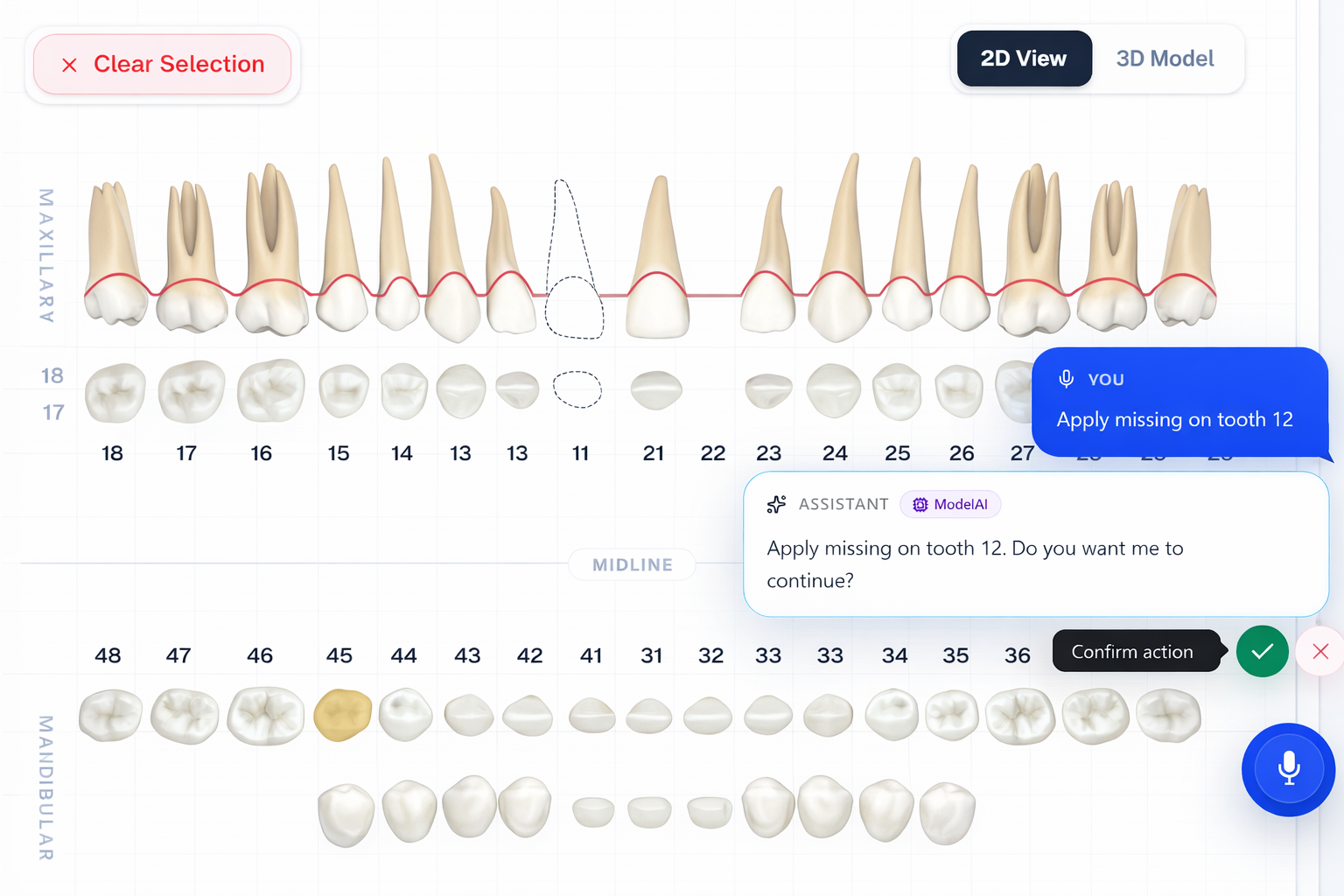 Dental chart screen with assistant confirmation controls for a selected tooth.