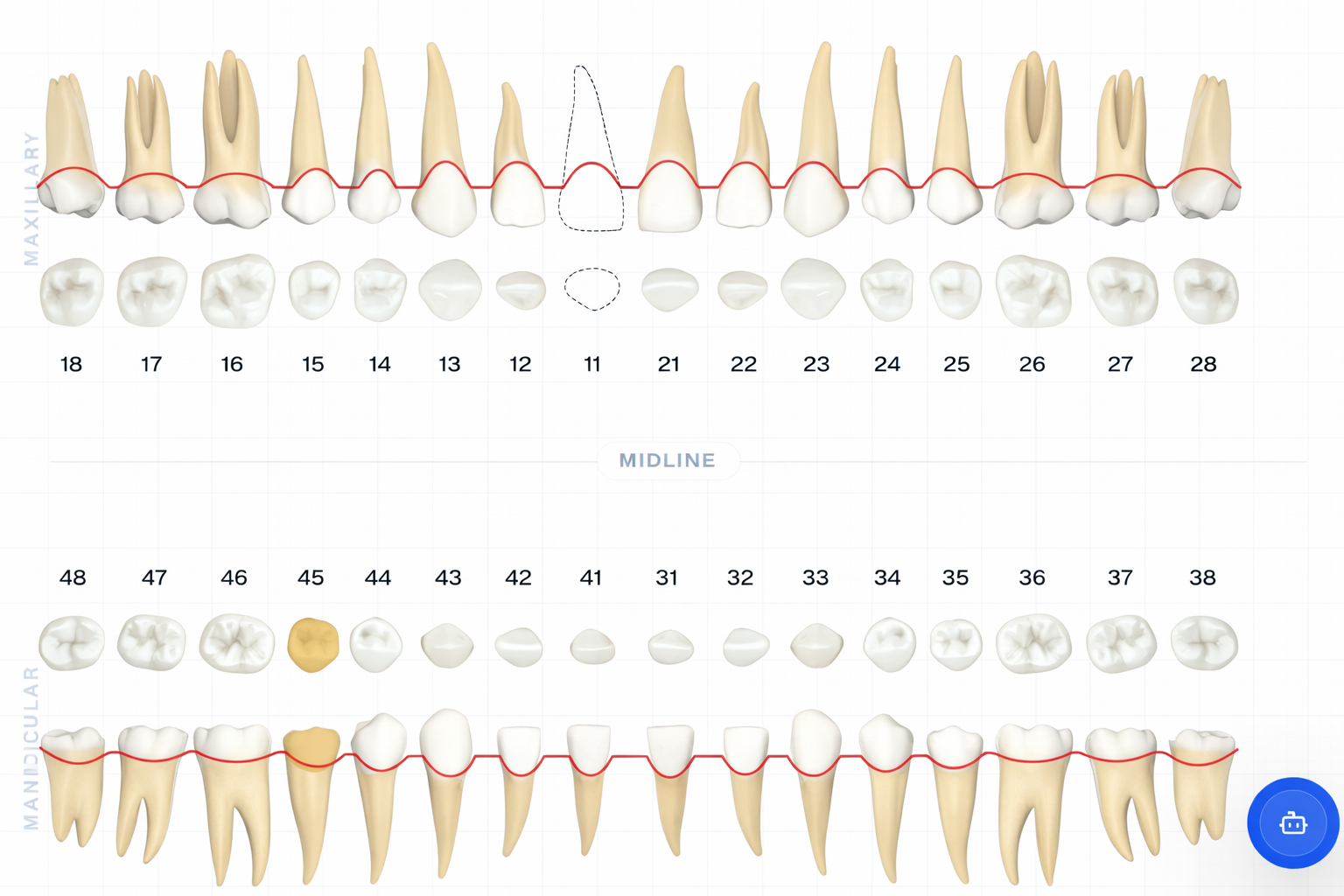 Full dental chart overview with upper and lower arches in the Oradentix interface.